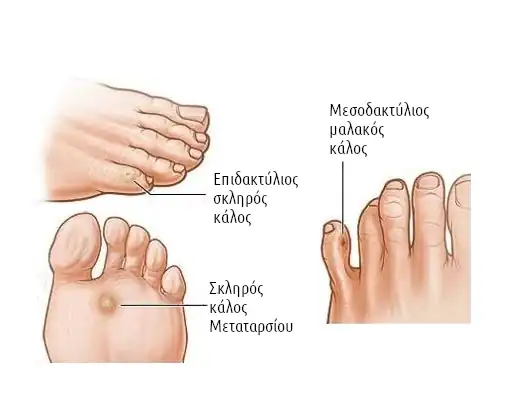 image FootTherapy