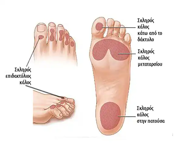 image FootTherapy