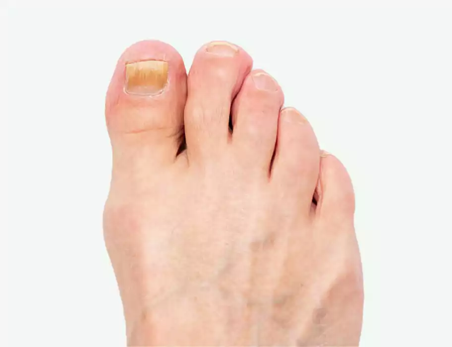 εικόνα για μασάζ πελμάτων FootTherapy